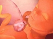 “Mẹ ơi, có bầu đừng khóc nha, con không muốn sinh ra lại là đứa trẻ đần đâu!”