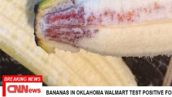 MỸ: RÚNG ĐỘNG 9 TRẺ NHIỄM HIV DO ĂN CHUỐI