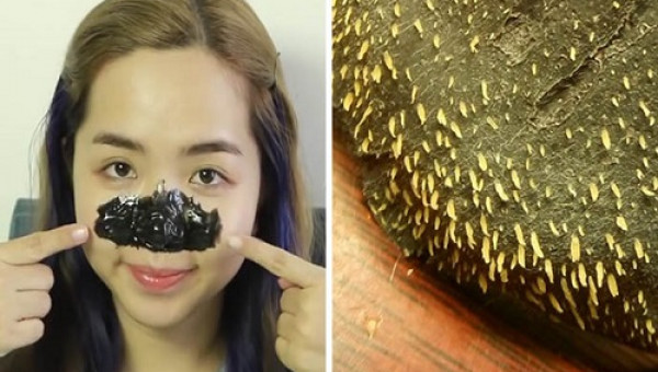 Lột ra được hàng trăm mụn đầu đen nhờ miếng lột mũi tự làm siêu dễ