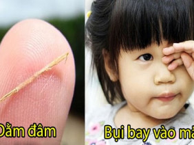 10 mẹo dân gian chữa dứt ngay bệnh vặt người Việt vẫn dùng hàng trăm năm qua