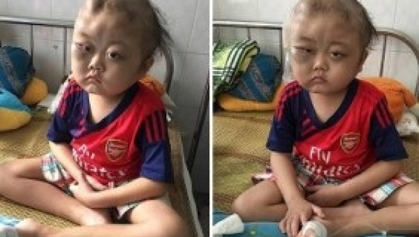 Cậu bé khiến nhiều người phải đau đến thắt lòng: “Mẹ về đi con ở đây chết 1 mình”