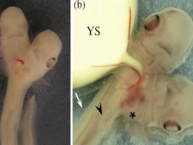 Lần đầu tiên tìm thấy phôi thai cá mập hai đầu