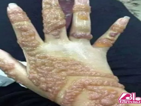 Cô gái trẻ nghiện xăm henna và cái kết rùng mình