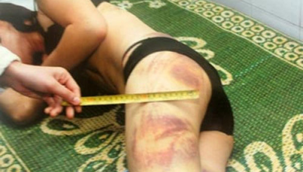 Bạo lực tình dục: Nhiều người đau đớn “chiều” chồng