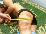 Bạo lực tình dục: Nhiều người đau đớn “chiều” chồng