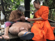 Người đàn ông Thái Lan khốn khổ vì chân to như voi