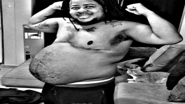 Vào viện khám lưng, người đàn ông phát hiện mình có thai