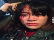 Hai thanh niên chơi gái không được liền quay sang đánh vỡ đầu người ta