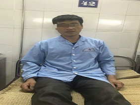 Người đàn ông bị đỉa chui vào mũi sau khi ăn rau sống
