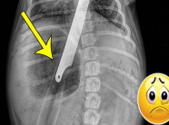 Chó cưng kêu rên, khó thở và chảy máu cam, chụp X quang phát hiện nguyên nhân đau lòng