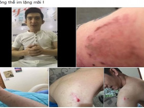 Hot: Bảo Duy khóc trong đau khổ tố bị Phi Thanh Vân đánh