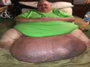 Người đàn ông 12 năm không thể ngủ chung với vợ vì hạ bộ quá khủng không ai dám nhìn