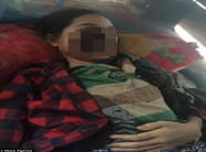 Thiếu nữ 18 tuổi bị phá hủy khuôn mặt sau khi nhổ 1 chiếc răng và đây là nguyên nhân