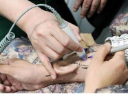 Người đàn ông Trung Quốc "mọc" tai trên tay