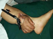 Bàn tay “mọc” lên ở cổ chân và sự thật đằng sau đó