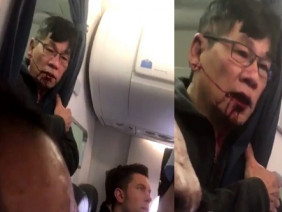 Xác nhận bác sĩ châu Á bị lôi khỏi máy bay United Airlines là người gốc Việt