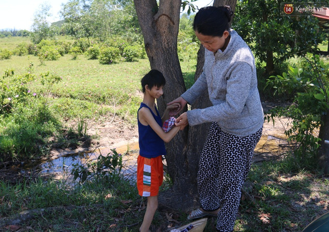 Cuộc sống cùng cực của cậu bé người khỉ 14 tuổi nhưng chỉ cao 0,8 mét, nặng 7kg ở Huế - Ảnh 12.