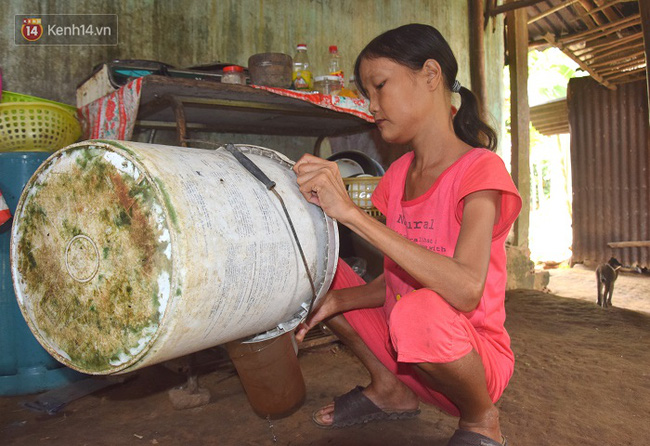 Cô gái mang khuôn mặt bà lão ở Quảng Nam: ăn gấp 10 lần người thường, uống mỗi ngày 36 lít nước - Ảnh 6.